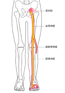 兵庫県尼崎市南武庫之荘のきりん接骨鍼灸院　坐骨神経痛の説明