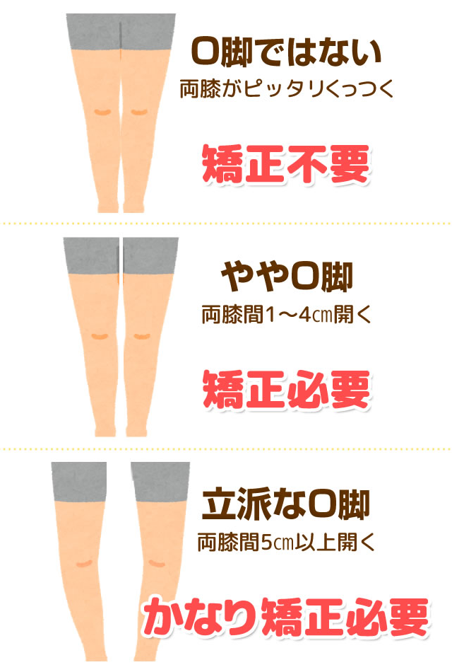 兵庫県尼崎市南武庫之荘のきりん接骨鍼灸院　変形性膝関節症