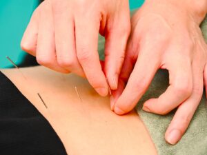 尼崎市南武庫之荘のきりん接骨鍼灸院です。鍼治療で過敏性腸症候群が改善